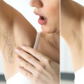 The Risks of Using an IPL/RF/Laser Combination Device for Hair Removal