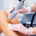 The Risks of Laser Hair Removal: What You Need to Know