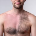 The Long-Term Effects of Laser Hair Removal: What You Need to Know