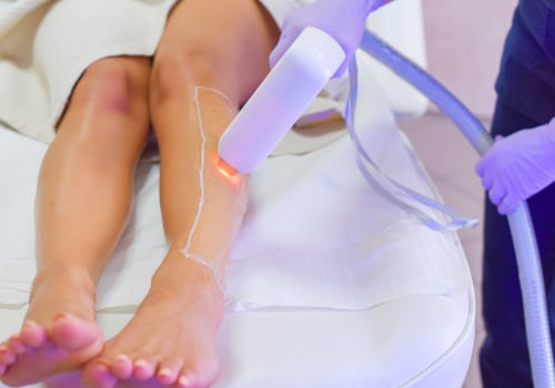 The Pros and Cons of Laser Hair Removal
