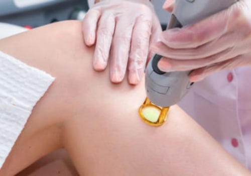 Does Laser Hair Removal Damage Collagen? An Expert's Perspective